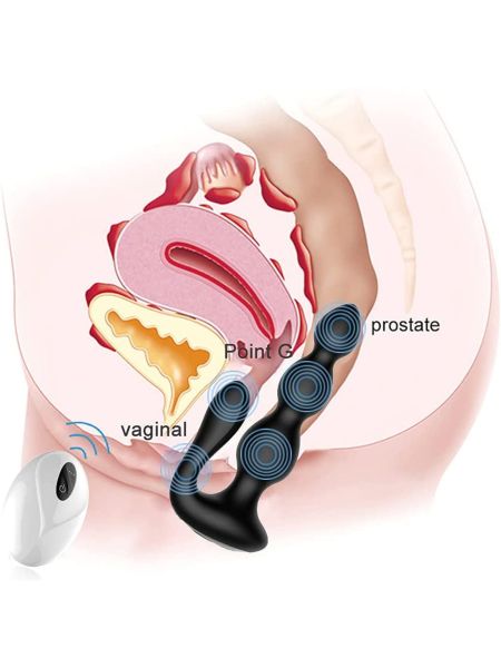 RemoteSilicone AnalBeads - 3